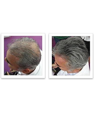 Caboki Hair Loss Concealer Hair Building Fiber 25g (Black) - Buy Online on SooperMarket.com