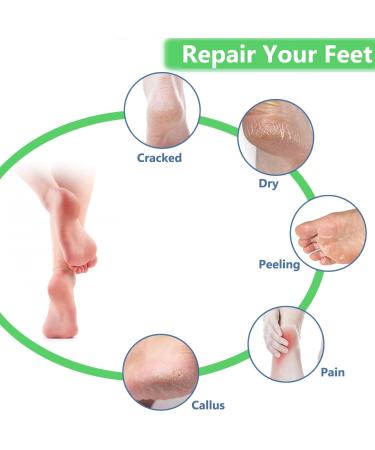 2 Pairs Moisturizing Gel Heel Socks Soft Ventilate Gel Heel Socks Open Toe Socks for Dry Hard Cracked Skin Moisturizing Day Night Care Skin (Black and Pink) 2p Black_pink - Buy Online on SooperMarket.com