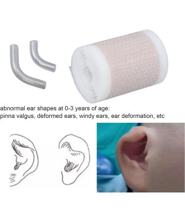 Baby Auricle Valgus Correction Patch - Silicone Gel Ear Tape for Newborns and Children - 100cm - Buy Online on SooperMarket.com