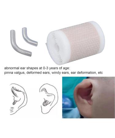 Baby Ear Corrector Patch - Skin-Friendly Gel Tape for Newborns - Comfortable Auricle Valgus Correction - Buy Online on SooperMarket.com