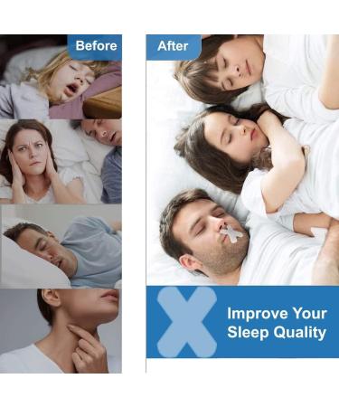 AntiSnoring Patch Nasal Strips Mouth Strips for Sleeping - 60 Count - Buy Online on SooperMarket.com