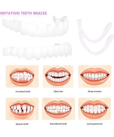 4 Pcs Fake Teeth Dentures for Women and Men - Temporary Dental Veneers for Natural, Comfortable Teeth Restoration, Protecting Your Smile - Buy Online on SooperMarket.com