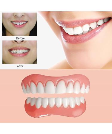 4 PCS Temporary Dental Veneers for Men and Women - Bright White W02 | Protect Your Teeth and Regain Confidence with Veneers Dentures Socket - Buy Online on SooperMarket.com