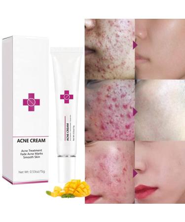 Onkessy Repair Acne Cream - Pimple Treatment for Men and Women - Hydrating & Oil Control Formula for Quick Acne Removal - Buy Online on SooperMarket.com