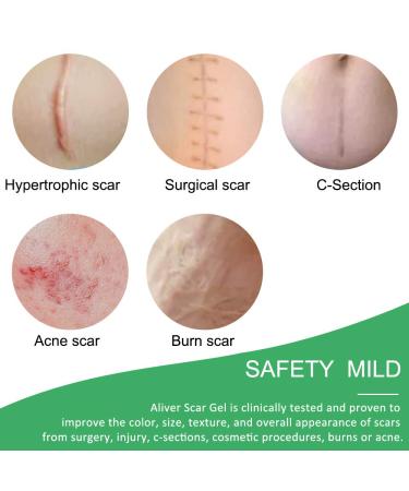 Silicone Scar Sheets - Advanced Treatment for Old & New Scars - 2 Months Supply - Buy Online on SooperMarket.com