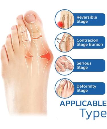Projoint Antibunions Health Socks - Bunion Relief & Corrector (4 Pair) - Buy Online on SooperMarket.com