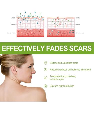 Dajidafu Women Belly Stretch Mark Body Acne Scars Removal Girls Repair Essence Anti-aging Beauty Supplies 30ml - Buy Online on SooperMarket.com