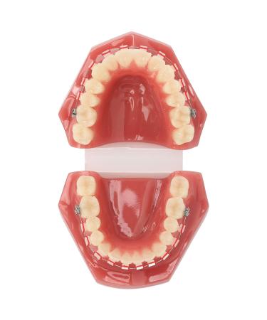 Orthodontic Demonstration Model for Dental Research | Metal Wires & Ceramic Brackets | Teaching Aids for Adults - Buy Internationally - Buy Online on SooperMarket.com