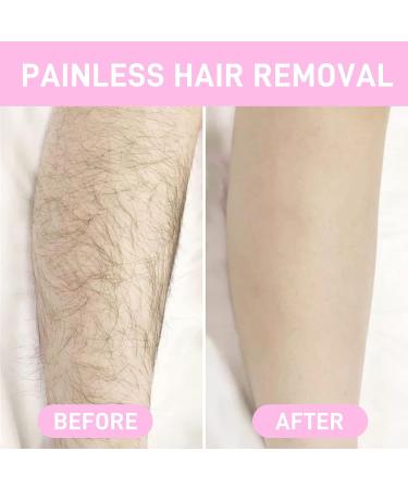 Koiernr Crystal Hair Eraser - Portable Mild Epilator for Painless Hair Removal - Skin Exfoliator Tool for Men and Women - Gold+Rose Red - Buy Online on SooperMarket.com