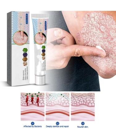 Face Cream Body Cream Anti-Itch Cream Chinese Herbal Cream Skin Repairing Cream for Face Body Cream for Itchy Skin Moisturizing Skin Cream 20 g - Buy Online on SooperMarket.com
