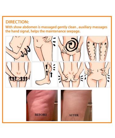Buy Natural Hot Cream for Cellulite Removal | Slimming & Tightening Body Cream for Waist & Buttocks - Buy Online on SooperMarket.com