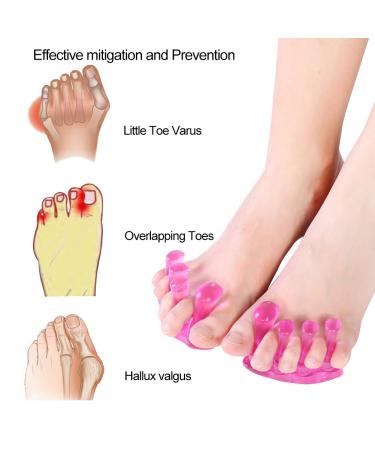 Rosa Silicone Toe Separator & Valgus Stretchers | Hammer Toe & Bunion Correction for Men & Women - International Shipping - Buy Online on SooperMarket.com