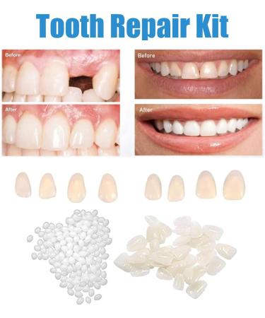 Tooth Repair Kit/Cavity Filler for Teeth/Tooth Repair Granules/Tooth Repair Kit for Chipped Teeth/Moldable False Teeth/Cavity Filler for Teeth/Temporary Filling for Tooth(30g) - Buy Online on SooperMarket.com
