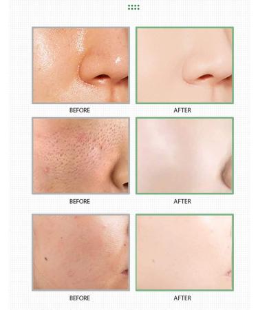Green Tea Stick Blackhead Remover (2Pcs) - Deep Pore Cleansing and Moisturizing with Green Tea Extract for Skin Brightening - Suitable for All Skin Types - Buy Online on SooperMarket.com