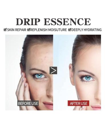 Eternity Vitamin C Serum - 2PCS Set | Face Spots & Hyaluronic Acid for Radiant Skin - Buy Online on SooperMarket.com