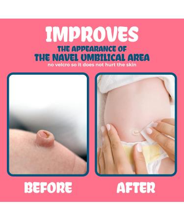 Baby Belly Button Shaper Plug | Umbilical Hernia Belt | Baby Stomach Band - Newborn Care Essentials - Buy Online on SooperMarket.com