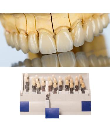 29 Color Porcelain Tooth Whitening Color Keys - Removable Tooth Elevation Table for Accurate Shade Matching - Buy Online on SooperMarket.com