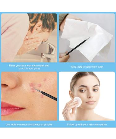 Fangze Pimple Popper Tool Kit - 10pcs Stainless Steel Blackhead Remover Set with Leather Bag - Buy Online on SooperMarket.com