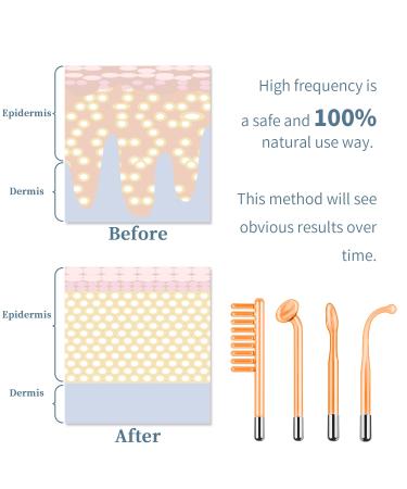Portable High Frequency Facial Machine with 4 Tubes | TUMAKOU Skin Wand - Buy Online on SooperMarket.com