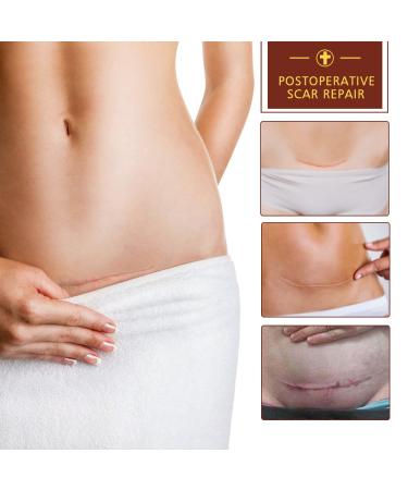 3 Pack TCM Scar Removal Cream - Scar Reducing Treatment for Stretch Marks, Acne Scars, Surgical Scars - 1.1 Ounce (Pack of 3) - Buy Online on SooperMarket.com