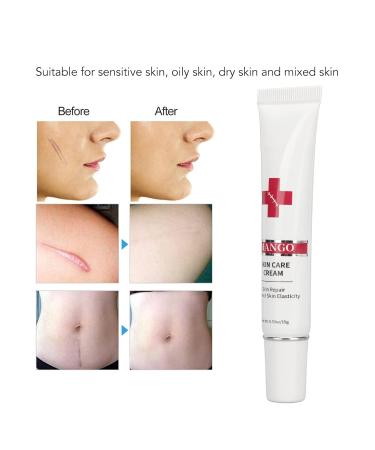 Nourishing Plant Based Scar Cream for Safe & Gentle Scar Repair - Buy Online on SooperMarket.com