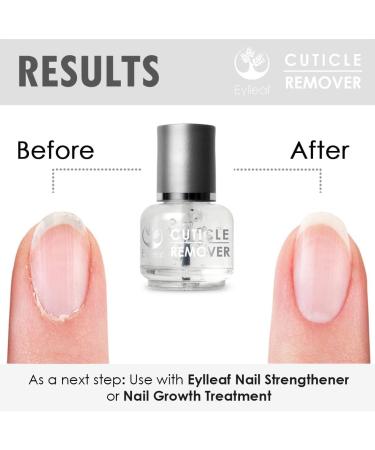 Eylleaf Liquid Cuticle Remover 15ml - Softens Dry and Dead Skin - Buy Online on SooperMarket.com