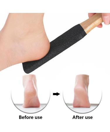 Foot File Foot Scrubber Dead Skin Remover Foot Callus Remover with Wooden Handle for Removes Hard Dead Skin Dry Calluses Rough and Cracked Corn Feet (Black) - Buy Online on SooperMarket.com