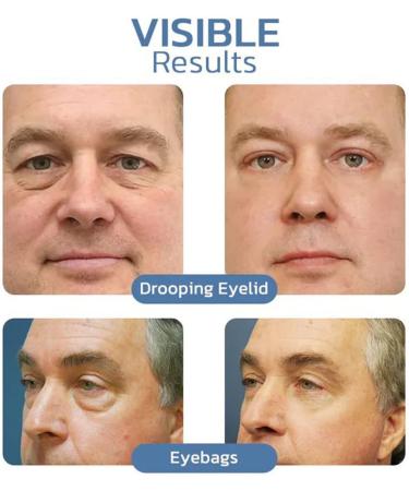 CHUANGJIA OPENEYES Peptide Lifting Eye Gel Set - Reduce Bags, Wrinkles, Dark Circles - 3PCS - Buy Online on SooperMarket.com