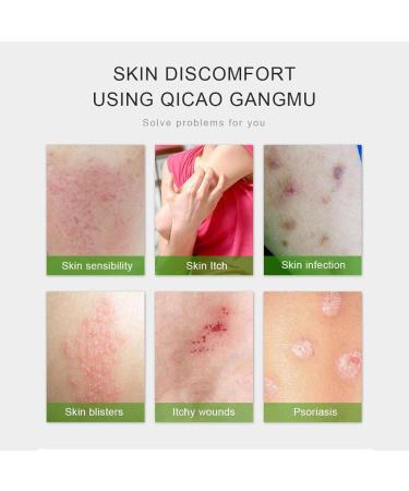 Herbal Anti-Itch Cream for Psoriasis, Dermatitis, Eczema - Multicolor, One Size - Buy Online on SooperMarket.com