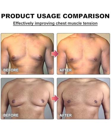 Buy Mentherm Bee Venom Gynecomenia Heating Oil & Gel | Strengthen Chest Muscles | International Shipping - Buy Online on SooperMarket.com