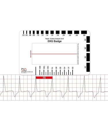 EKG PVC Badge Card Accurately Interpret ECG/EKG Rhythm Strips and 12 Lead EKG Without EKG Calipers for Nurse NHS or Anyone in Healthcare!