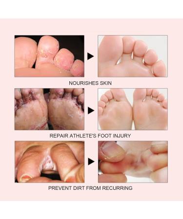 Feet Foot Repairing Cream - Moisturizing Balm for Dry Cracked Heels | 15g/0.53oz - Best Remedy for Dry Feet - Buy Online on SooperMarket.com