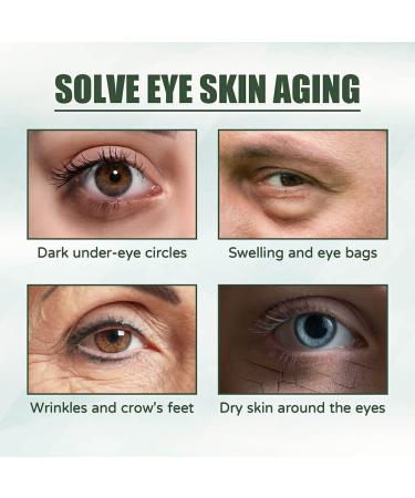 FIOERDTUIE Adults Eye Tightening Cream Nourishing Anti-wrinkle Dark Circle Creams Wrinkle Remover Skin Care Beauty Supplies - Buy Online on SooperMarket.com