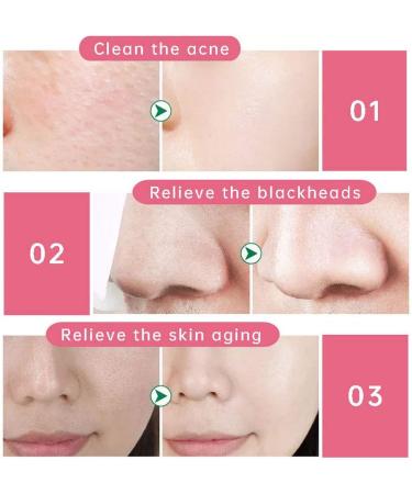 60pcs Exfoliating Silkworm Balls for Face Care | Silk Blackhead Removal & Skin Scrub - Buy Online on SooperMarket.com