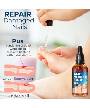 2PCS German Toenailplus Anti Paronychia Relief Oil - Nail Repair for Damaged Thick Nails - Buy Online on SooperMarket.com