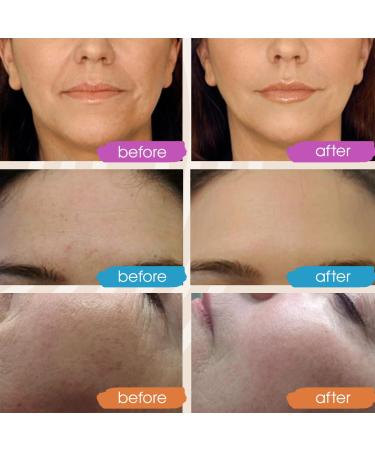 Intro Offer: Retinol + Vitamin C + Hyaluronic Acid Anti-Aging Face Serum by GLEOW - 3x1 fl oz Pack - Buy Online on SooperMarket.com