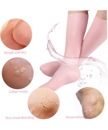 Moisturising Socks 1Pair Anti Slip Elastic Silicone Socks Comfortable Overnight Gel Socks Reusable Foot Moisturiser Socks for Repairing Dry Feet (Pink) Style2 - Buy Online on SooperMarket.com