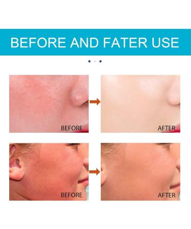 Sunscreen Sun Stick Sunscreen Stick Sunstick Protection Bar Sunscreen SPF 50+ Sun Cream Stick SPF 50 Ultra Light UV Protetion Suncream Long Lasting Sunscreen Easy Use Ideal for All Skin Types 20g - Buy Online on SooperMarket.com