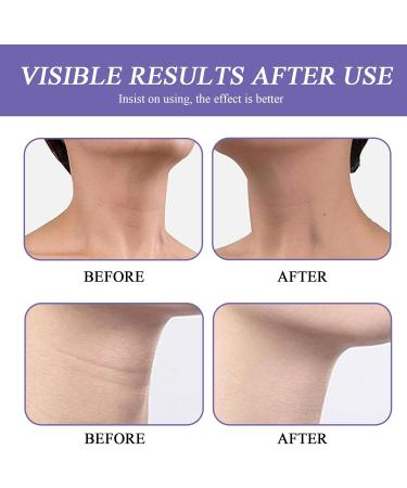 wimony Neck Firming Cream Strengthen Neck Skin Tightening Cream Neck Firming Sagging Skin Aging Skin & Saggy Skin Reduce Wrinkles & Smoothing Neck Fine LIines-Neck&Body - Buy Online on SooperMarket.com