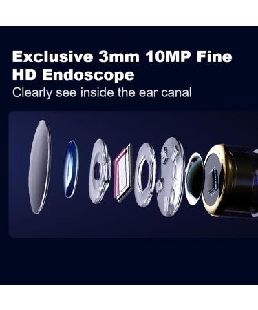 Smart Visible Ear Cleaner with 360 Degree Wide Angle 3.2mm Lens, LED Light, 10MP HD Camera, and 6 Gyroscopes for Effective Earwax Removal - White - Buy Online on SooperMarket.com