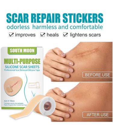 Silicone Scar Gel Strip - Efficient Scar Treatment for Surgery, Acne & Trauma - 4 * 150cm - Buy Online on SooperMarket.com