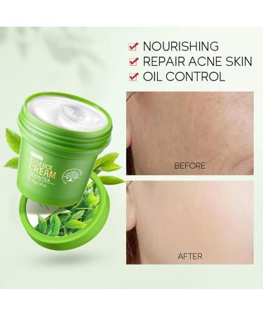 Skincare Set For Teenagers Girls Face Care Sets Skincare Gift Set 4PC Pamper Gifts For Women Includes Cleanser-Eye Cream-Serum-Face Cream Suitable For All Skin Types (One Size Green Tea) Green Tea One Size - Buy Online on SooperMarket.com