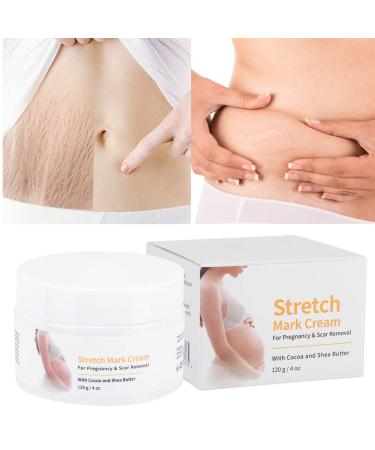 Stretch stripes stretch marks cream remove pregnancy scars acne cream strain strip treatment maternity repair 120g