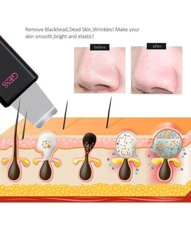 GESS 3-in-1 Microcurrent Facial Device | Skin Scrubber & Face Spatula | 3D Facial Roller Massager | Handheld Skin Toning Device for Home Use - Shop Internationally - Buy Online on SooperMarket.com