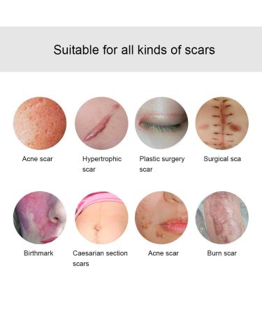 Scar Repair Cream for Face and Body - Scar Removal Gel for Better Skin Healing - Buy Online on SooperMarket.com