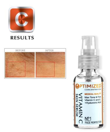 Anti-Aging Vitamin C Serum | Medical Grade with Vitamin E & Hyaluronic Acid | Fades Age Spots & Evens Skin Tone - Buy Online on SooperMarket.com