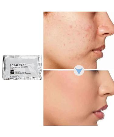 Scar Removal Cream | Smoothing Skin & Reduce Formation of Connective Tissue | Repair Cream for Burn & Old Scars | Easy to Use - Buy Online on SooperMarket.com