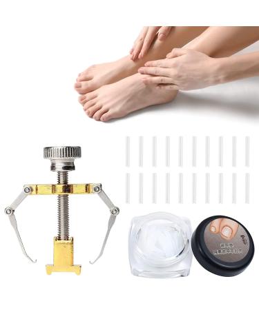 Ingrown Toenails Set Toenail Correction Toenail Toenail Patch Ingrown Toenails Tool Set Toenail Corrector Pedicure Tools Correction Sticker Toe Nails 21 Pieces