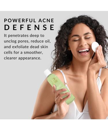 Double O Complex Astringent by Flori Roberts | 20% Salicylic Acid Acne Treatment | Clear Blemishes & Cleanse Pimples - International Shipping Available - Buy Online on SooperMarket.com