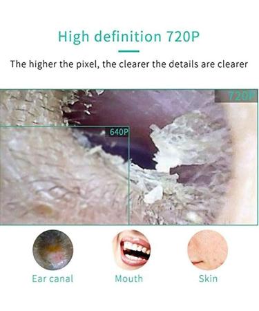 KANDUO Ear Wax Removal Tool - Visual 5.5mm HD Ear Endoscope for Adults & Kids - Buy Online on SooperMarket.com